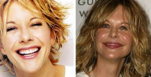 Meg Ryan